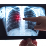 Radiología