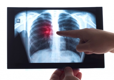 Radiología