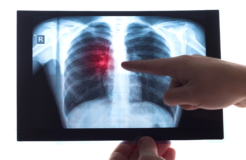 Radiología